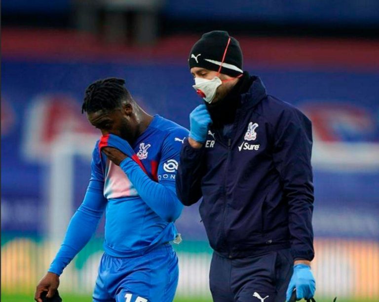 Crystal Palace winger Jeffrey Schlupp ruled out for months
