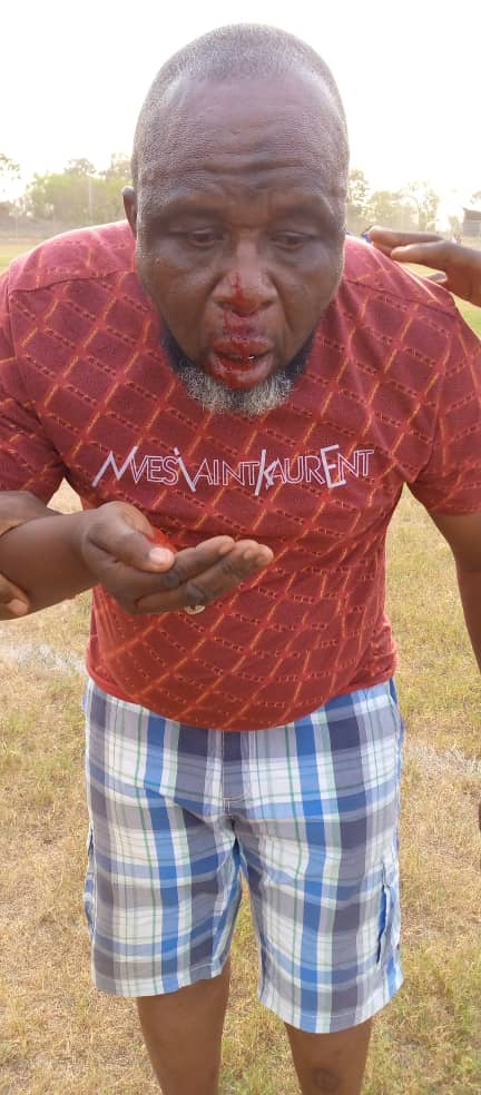 VIDEO: Players and Officials of RTU physically assaulted by fans of Nsoatreman FC